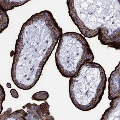 Immunohistochemistry-Paraffin: Syndecan-1/CD138 Antibody [NBP3-16984]