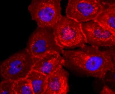 Immunocytochemistry/ Immunofluorescence: Syndecan-1/CD138 Antibody (JM11-21) [NBP2-67174]