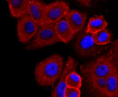 Immunocytochemistry/ Immunofluorescence: Syndecan-1/CD138 Antibody (JM11-21) [NBP2-67174]