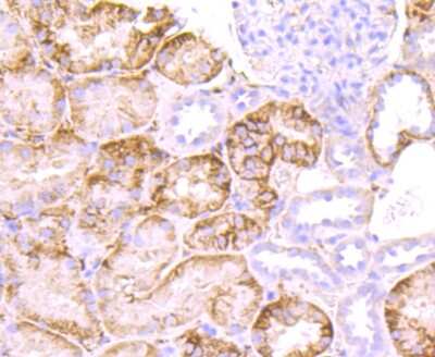 Immunohistochemistry-Paraffin: Syndecan-1/CD138 Antibody (JM11-21) [NBP2-67174]