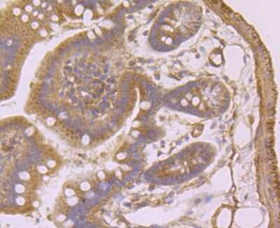 Immunohistochemistry-Paraffin: Syndecan-1/CD138 Antibody (JM11-21) [NBP2-67174]