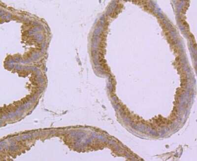 Immunohistochemistry-Paraffin: Syndecan-1/CD138 Antibody (JM11-21) [NBP2-67174]