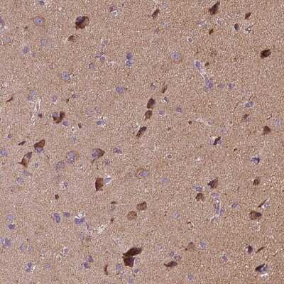 Immunohistochemistry-Paraffin: Synphilin-1 Antibody [NBP2-55955]
