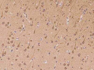 Immunohistochemistry-Paraffin: Synphilin-1 Antibody [NBP3-06159]