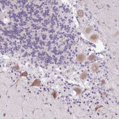 Immunohistochemistry-Paraffin: Syntabulin/GOLSYN Antibody [NBP2-30921]
