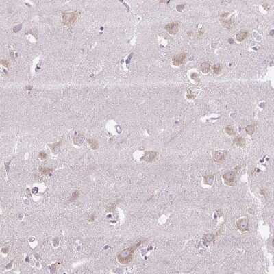Immunohistochemistry-Paraffin: Syntabulin/GOLSYN Antibody [NBP2-30921]