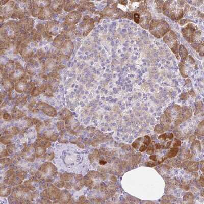 Immunohistochemistry-Paraffin: Syntabulin/GOLSYN Antibody [NBP2-30921]