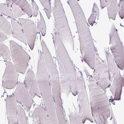 Immunohistochemistry-Paraffin: Syntabulin/GOLSYN Antibody [NBP2-30921]