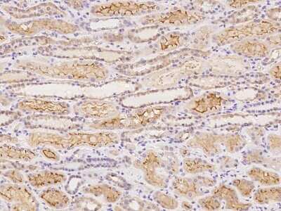 Immunohistochemistry-Paraffin: Syntaphilin Antibody [NBP2-98037]