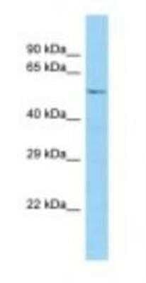 Western Blot: Syntaphilin Antibody [NBP1-98477]