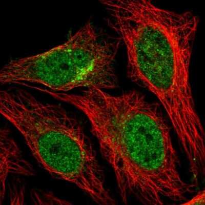 Immunocytochemistry/ Immunofluorescence: Syntaxin 12 Antibody [NBP2-58568]