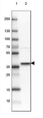 Western Blot: Syntaxin 16 Antibody [NBP1-92467]