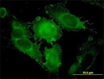 Immunocytochemistry/ Immunofluorescence: Syntaxin 1A Antibody (1B11-1A8) [H00006804-M02]