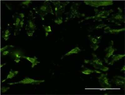 Immunocytochemistry/ Immunofluorescence: Syntaxin 4 Antibody (6A1) [H00006810-M02]