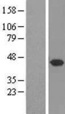 Western Blot: Syntaxin 5 Overexpression Lysate [NBL1-16583]