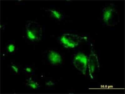 Immunocytochemistry/ Immunofluorescence: Syntaxin 6 Antibody (1G2) [H00010228-M01]