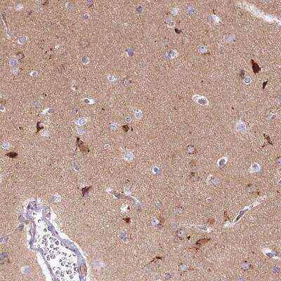 Immunohistochemistry-Paraffin: Syntaxin 6 Antibody [NBP1-85869]