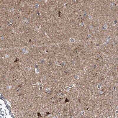 Immunohistochemistry-Paraffin: Syntaxin 6 Antibody [NBP2-38417]