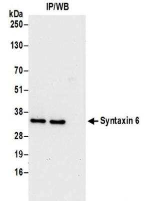 Immunoprecipitation: Syntaxin 6 Antibody [NBP2-32270]