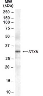 Western Blot: Syntaxin 6 Antibody [NB100-2920]