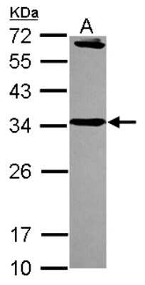 Western Blot: Syntaxin 6 Antibody [NBP2-15132]