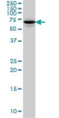 Western Blot: Syntaxin-BP1 Antibody (6D1) [H00006812-M01]