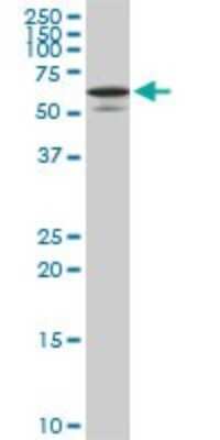 Western Blot: Syntaxin-BP1 Antibody (6D1) [H00006812-M01]