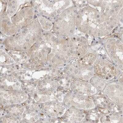 Immunohistochemistry-Paraffin: Syntaxin-BP3/Munc18c Antibody [NBP1-80636]