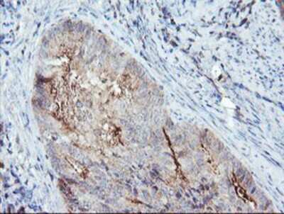 Immunohistochemistry-Paraffin: Syntenin 1 Antibody (OTI2H6) [NBP2-02072]
