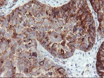 Immunohistochemistry-Paraffin: Syntenin 1 Antibody (OTI2H6) [NBP2-02072]