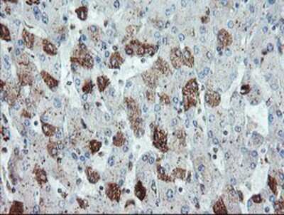 Immunohistochemistry-Paraffin: Syntenin 1 Antibody (OTI2H6) [NBP2-02072]