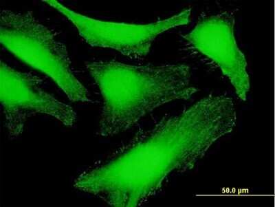 Immunocytochemistry/ Immunofluorescence: Syntenin 1 Antibody [H00006386-B01P]