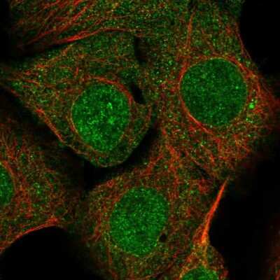Immunocytochemistry/ Immunofluorescence: Syntenin 1 Antibody [NBP1-86979]