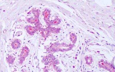 Immunohistochemistry-Paraffin: Syntenin 1 Antibody [NB100-53807]