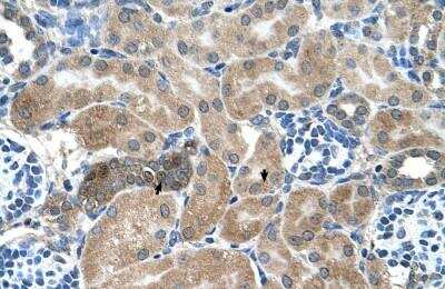 Immunohistochemistry-Paraffin: Syntenin 1 Antibody [NBP1-59336]