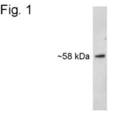 Western Blot: Syntrophin Antibody (1351) [NB600-1294]