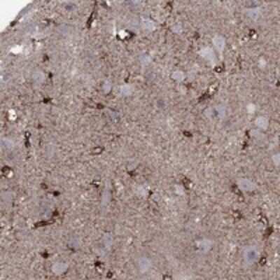 Immunohistochemistry-Paraffin: Syntrophin Antibody [NBP3-17941]