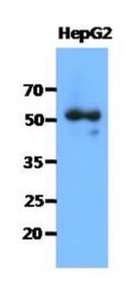 Western Blot: Syntrophin alpha 1 Antibody (1E1)BSA Free [NBP2-22587]