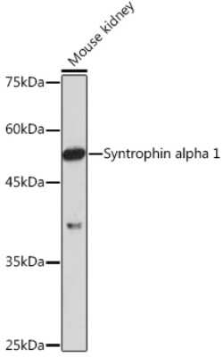 Western Blot: Syntrophin alpha 1 Antibody (3B10G10) [NBP3-15899]
