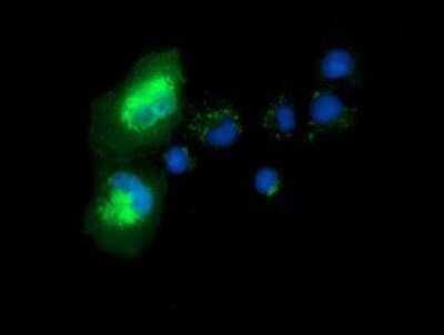 Immunocytochemistry/ Immunofluorescence: Syntrophin alpha 1 Antibody (OTI1H10) - Azide and BSA Free [NBP2-74422]