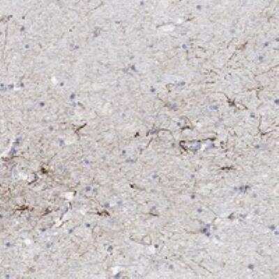 Immunohistochemistry-Paraffin: Syntrophin gamma 2 Antibody [NBP3-17441]