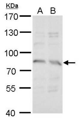 Western Blot: Syntrophin gamma 2 Antibody [NBP2-43799]
