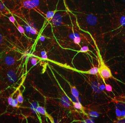 Immunocytochemistry/ Immunofluorescence: alpha-Synuclein Antibody [NBP2-25146]