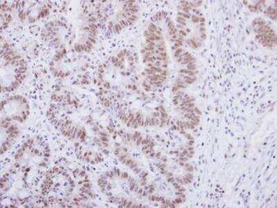 Immunohistochemistry-Paraffin: alpha-Synuclein Antibody [NBP2-15365]
