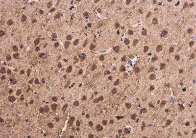 Immunohistochemistry-Paraffin: alpha-Synuclein Antibody [NBP2-15365]