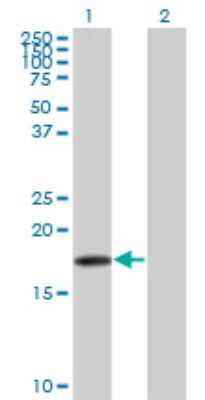Western Blot: beta-Synuclein Antibody (3H4) [H00006620-M07]