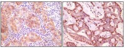 Immunohistochemistry-Paraffin: gamma-Synuclein Antibody (1H10D2) - BSA Free [NB110-60497]