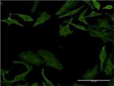 Immunocytochemistry/ Immunofluorescence: T Plastin Antibody (5B9) [H00005358-M01]