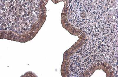 Immunohistochemistry-Paraffin: T Plastin Antibody (GT236) [NBP3-13517]