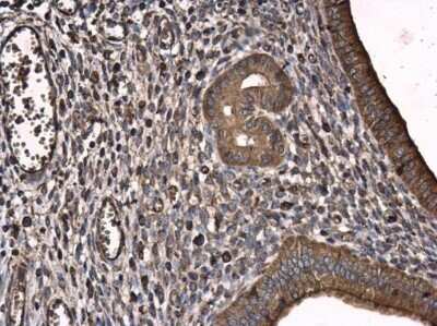 Immunohistochemistry-Paraffin: T Plastin Antibody (GT3310) [NBP3-13518]